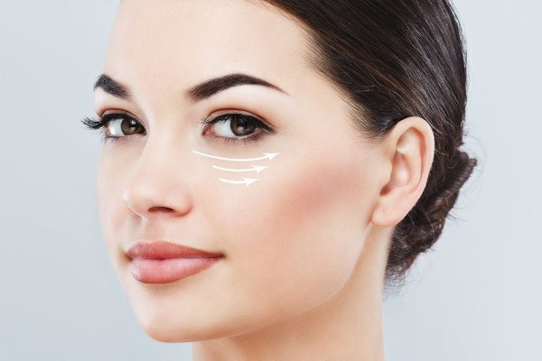 كيفية إجراء الحشوة الضوئية تحت العين؟