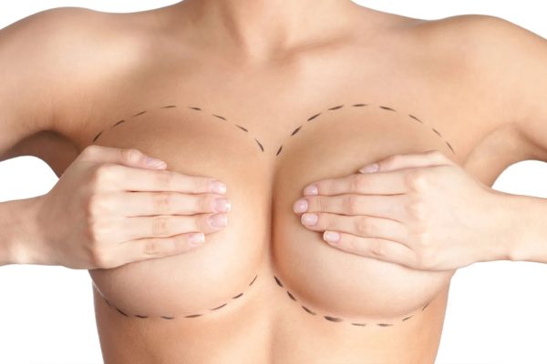 Breast Reduction