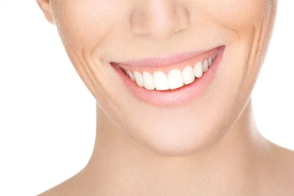 Gummy Smile