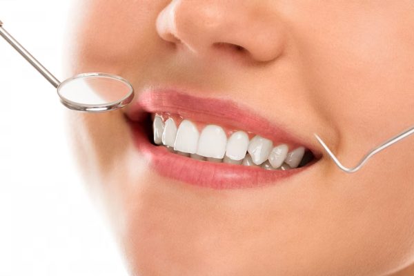 Porcelain Dental Veneer