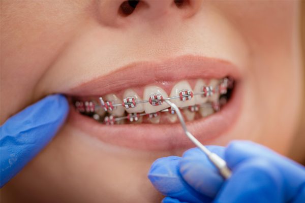 Orthodontie